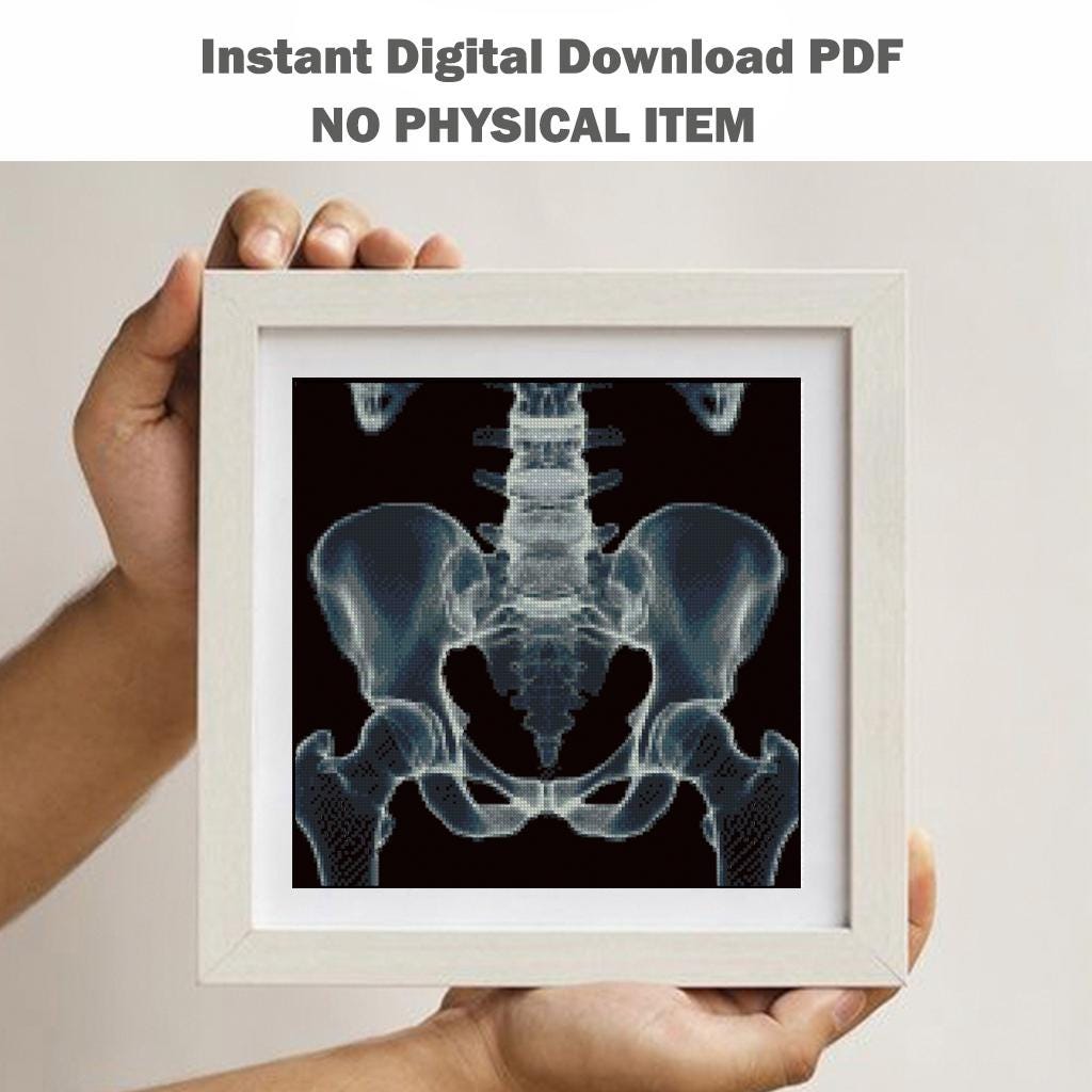 Pelvis X Ray Cross Stitch Pattern PDF, Human Hip Bone Anatomy Embroidery Design, Medical Skeleton Wall Art Download, Pattern Keeper - NuttyHappyHobby