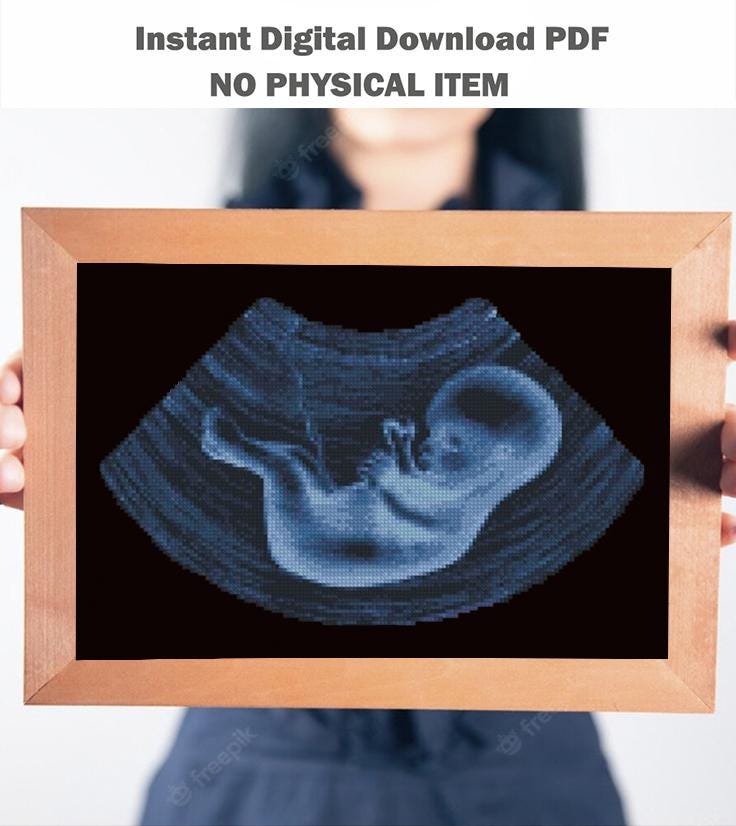 Ultrasound Baby Cross Stitch Pattern PDF, X Ray Fetus Anatomy Embroidery Design, Pregnancy Keepsake Wall Art Download - NuttyHappyHobby
